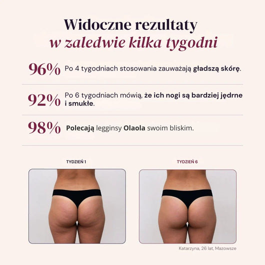 Legginsy Modelujące 3D – Push-Up & Antycellulitowe